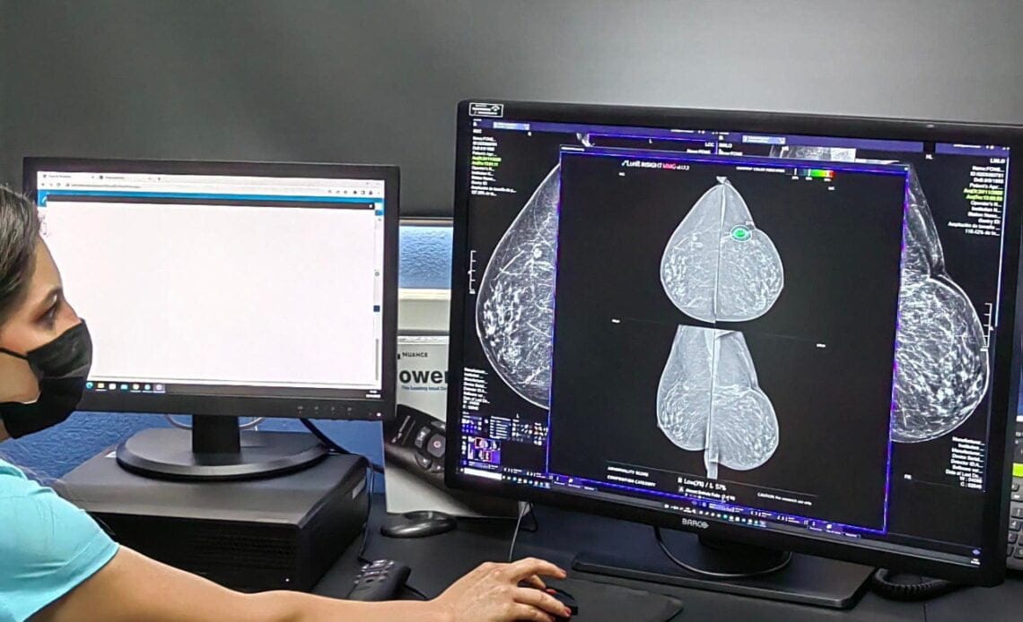 Hospitales del Pacífico Central se encuentran el proyecto Redimed para la digitalización del servicios de radiología 1 digitalizacion de radiografias