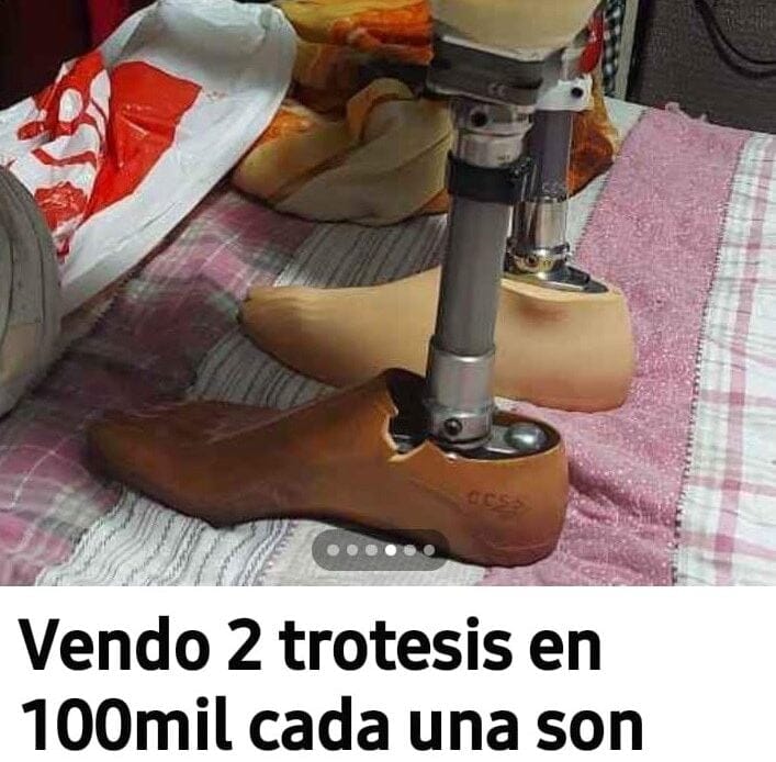 Las prótesis de la CCSS no se venden porque son únicamente para la persona afectada 1 protesis