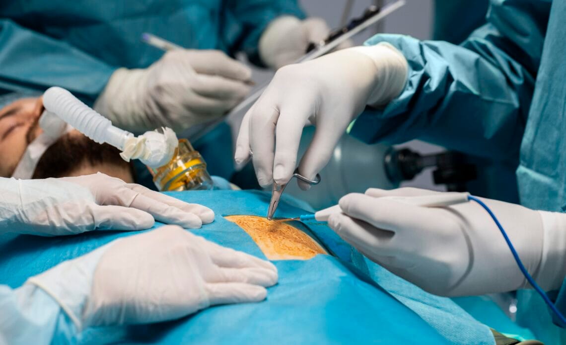 Trasplante de hígado trasformó la vida de un paciente hace 14 años 1 medicos que realizan procedimiento quirurgico paciente