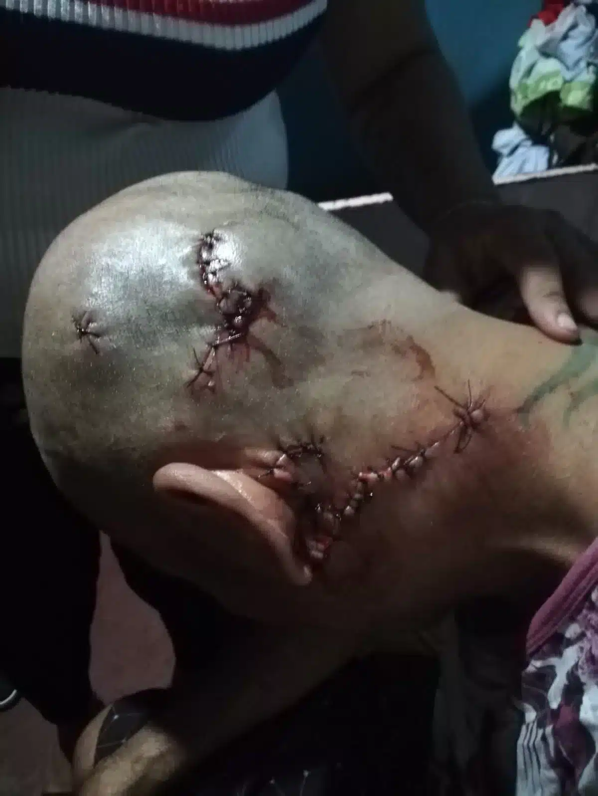 Herido en Barranca de Puntarenas